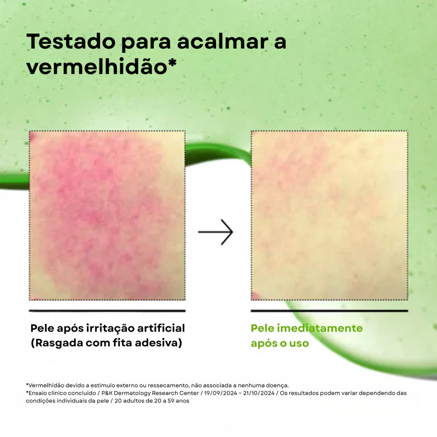 Sérum Calmante com Ácido Azelaico 10 e Ácido Hialurônico